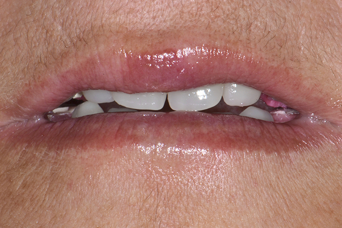 Step 6 Kontrolle der richtigen Relation zwischen &Auml;sthetik und Funktion