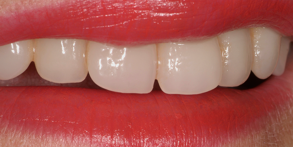 Masterpiece Carlo Montesarchio 1 Masterpiece Carlo Montesarchio 1