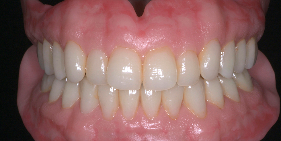 Masterpiece Carlo Montesarchio 2 Masterpiece Carlo Montesarchio 2