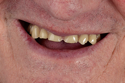 Initial situation Initial situation