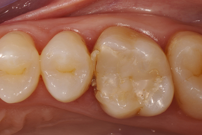 Initial situation Initial situation