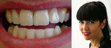 VITA Patientenfall Urszula Młynarska VITA Patientenfall Urszula Młynarska