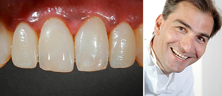 VITA Patientenfall Dr. Gerhard Werling VITA Patientenfall Dr. Gerhard Werling