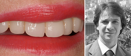 VITA Patientenfall Carlo Montesarchio VITA Patientenfall Carlo Montesarchio