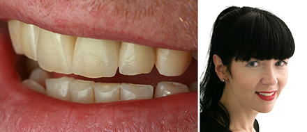 VITA Patientenfall von Urszula Młynarska VITA Patientenfall von Urszula Młynarska