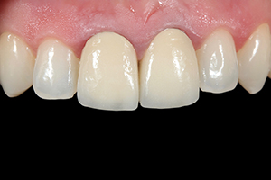 Patientenfall Marcio Breda