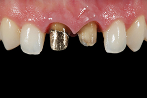 Patientenfall Marcio Breda: Ausgangssituation