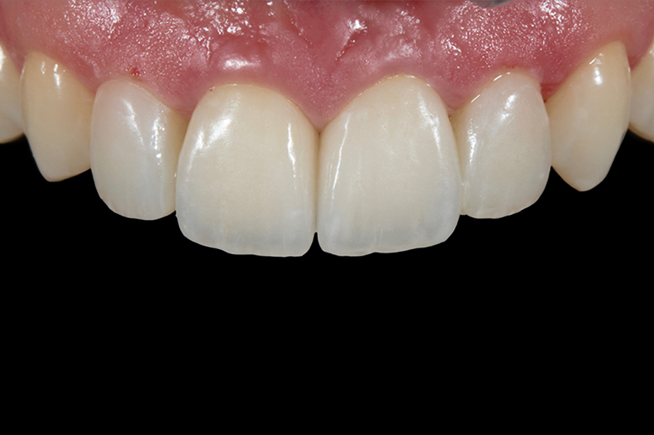 Patientenfall Marcio Breda: Korrekturen