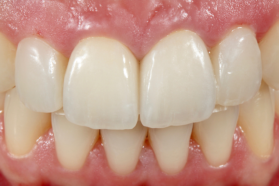 Patientenfall Marcio Breda: Korrekturen