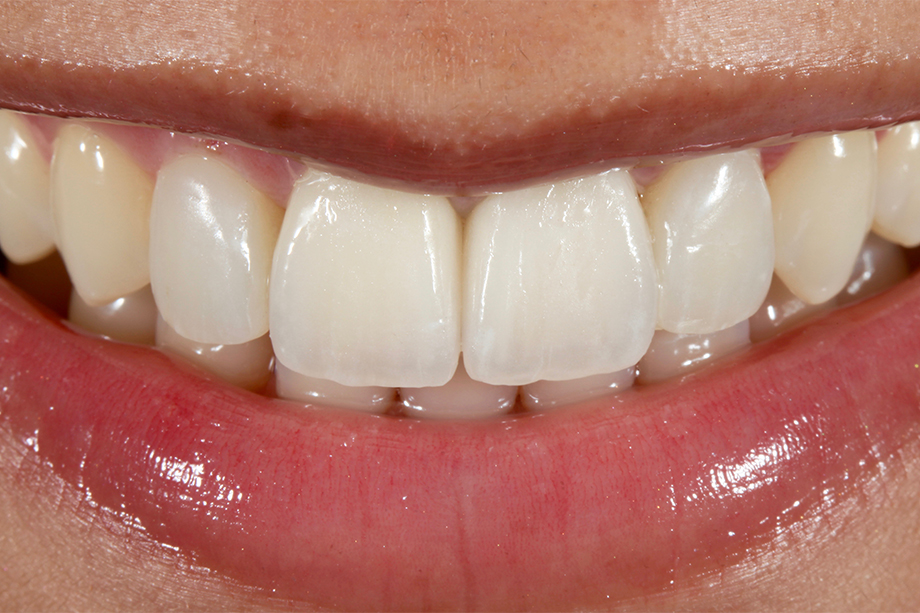 Patientenfall Marcio Breda: Patientin