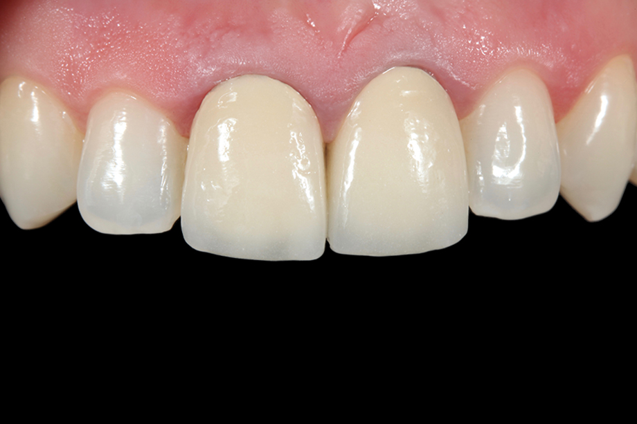 Patientenfall Marcio Breda