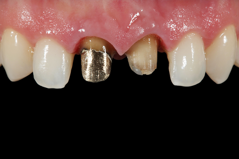 Patientenfall Marcio Breda: Ausgangssituation