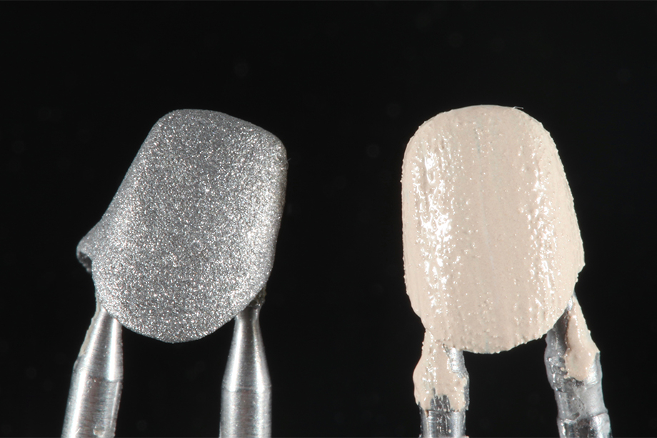 Patientenfall Marcio Breda: Sandstrahlen