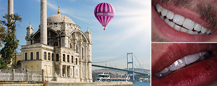 Patientenfall Halit Yağcı. Bursa, Türkei. Patientenfall Halit Yağcı. Bursa, Türkei.