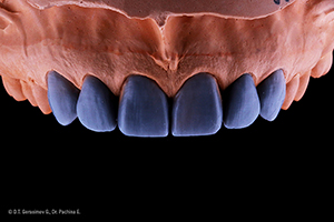 Caso cl&iacute;nico Georgy Gerasimov: Situaci&oacute;n de partida