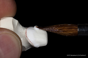 Caso cl&iacute;nico Georgy Gerasimov