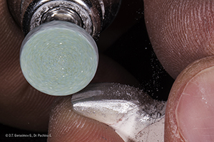 Caso cl&iacute;nico Georgy Gerasimov