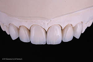 Caso cl&iacute;nico Georgy Gerasimov