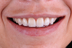 Caso cl&iacute;nico Georgy Gerasimov