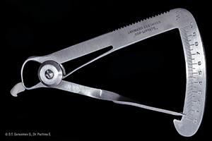 Caso cl&iacute;nico Georgy Gerasimov