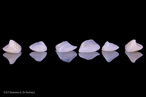 Caso cl&iacute;nico Georgy Gerasimov