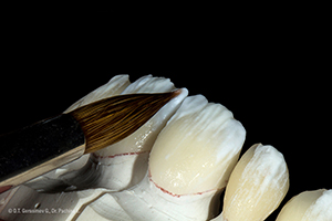 Caso cl&iacute;nico Georgy Gerasimov