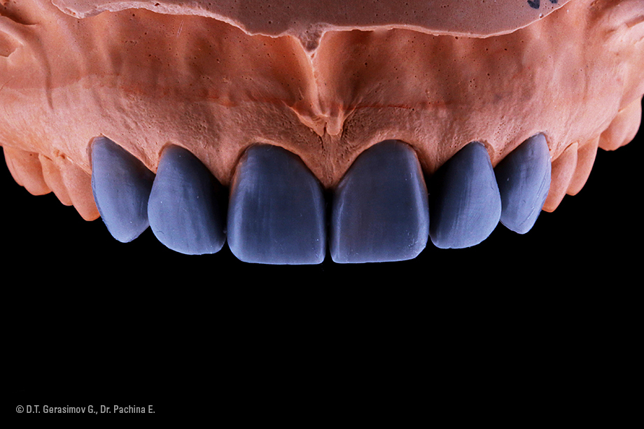 Caso cl&iacute;nico Georgy Gerasimov: Situaci&oacute;n de partida