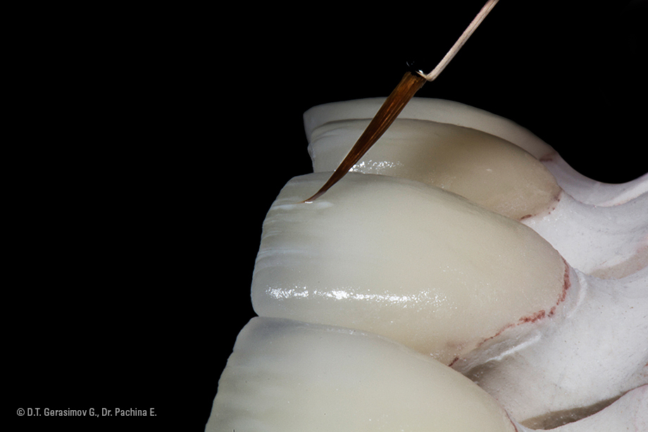 Caso cl&iacute;nico Georgy Gerasimov