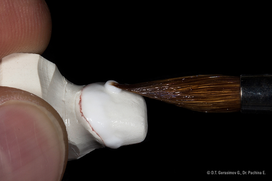 Caso cl&iacute;nico Georgy Gerasimov