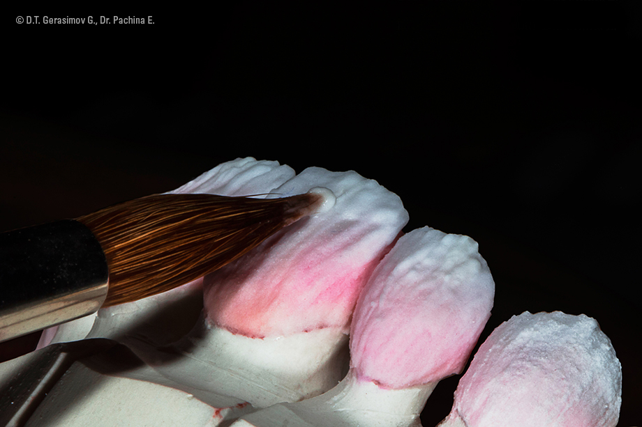 Caso cl&iacute;nico Georgy Gerasimov