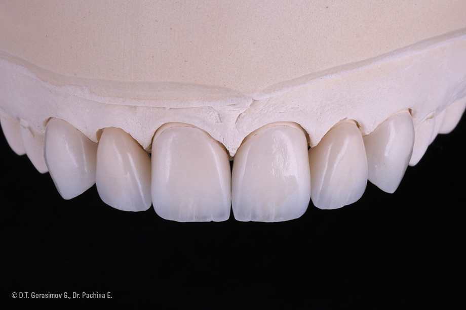 Caso cl&iacute;nico Georgy Gerasimov