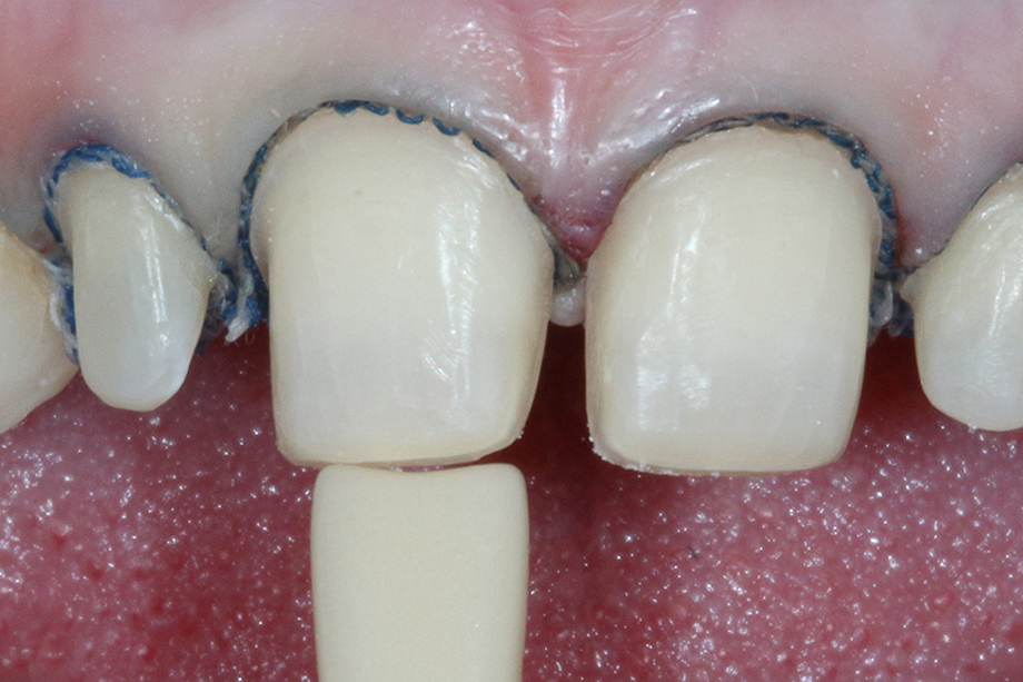 Caso cl&iacute;nico Georgy Gerasimov: Situaci&oacute;n de partida