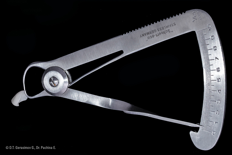 Caso cl&iacute;nico Georgy Gerasimov