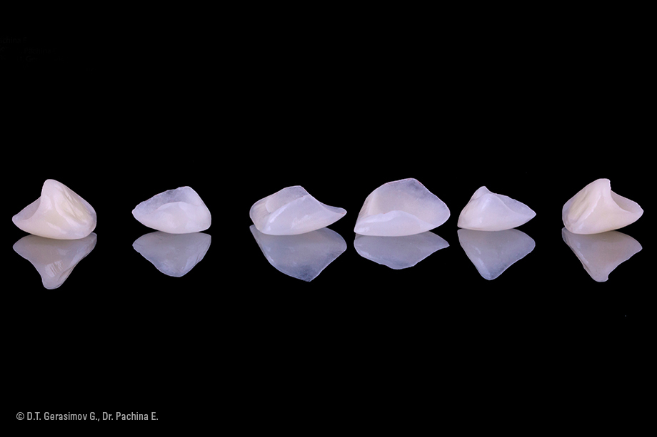 Caso cl&iacute;nico Georgy Gerasimov