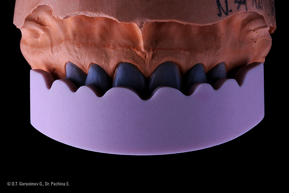 Caso cl&iacute;nico Georgy Gerasimov: Situaci&oacute;n de partida