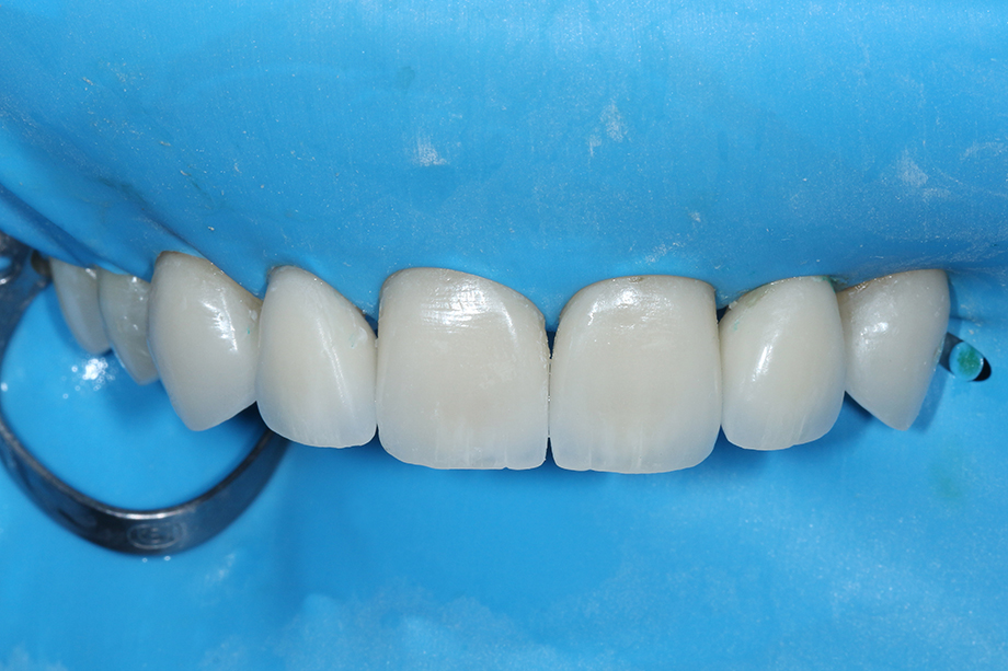 Caso cl&iacute;nico Georgy Gerasimov