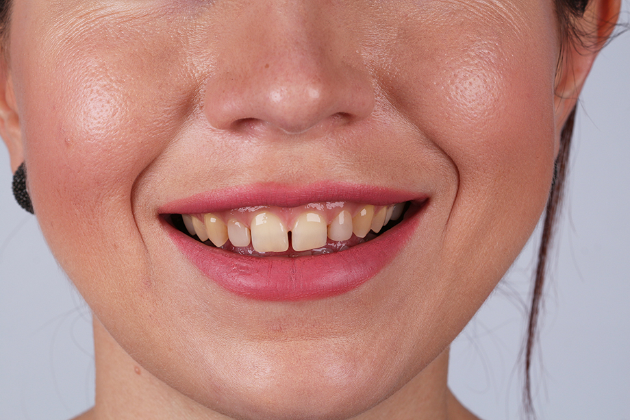 Caso cl&iacute;nico Georgy Gerasimov: Situaci&oacute;n de partida