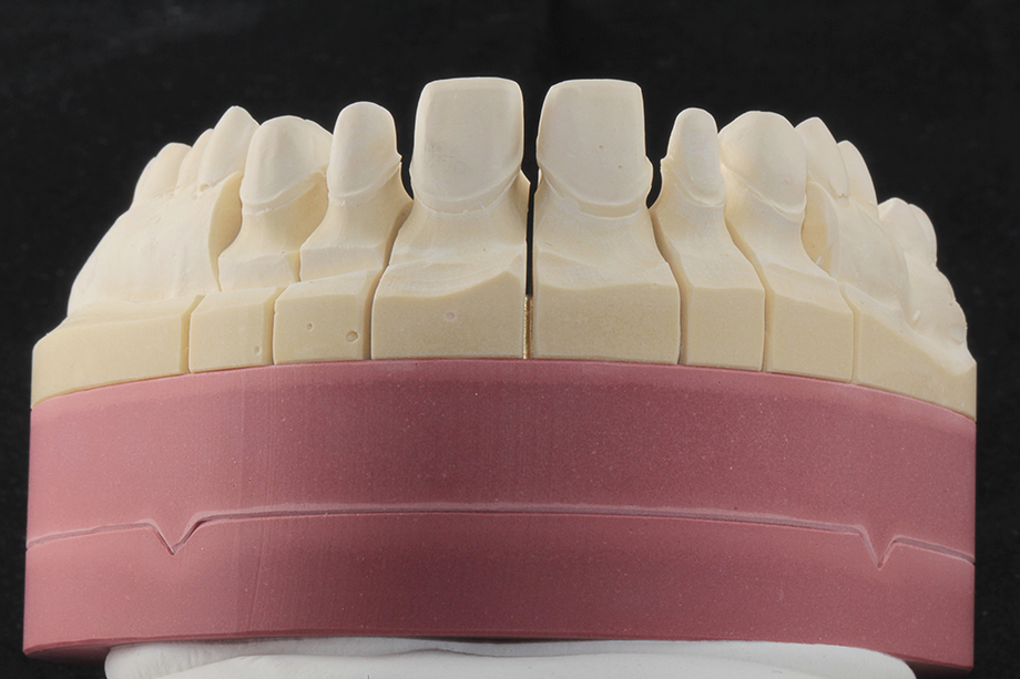 Caso cl&iacute;nico Georgy Gerasimov: Situaci&oacute;n de partida