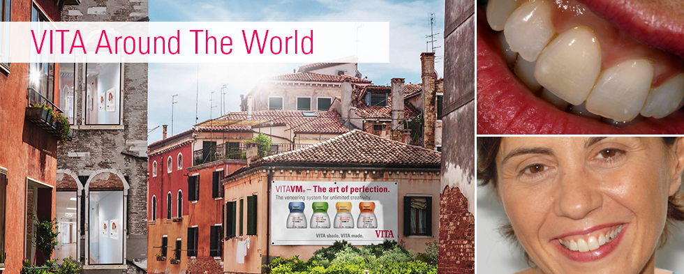 Patientenfall: Einzelne Frontzahnkrone aus VITAPM&reg;9. Francesco Ferretti Rom, Italien.