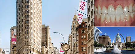 Patientenfall von Amos Harting, USA. Frontzahnrestauration Patientenfall von Amos Harting, USA. Frontzahnrestauration